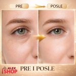 pre i posle efekat retinol seruma za područje oko očiju